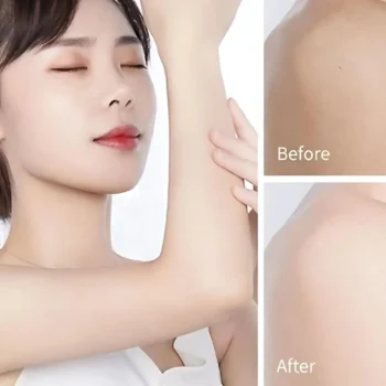 Hally Nicotinamide Moisturizing Body Lotion