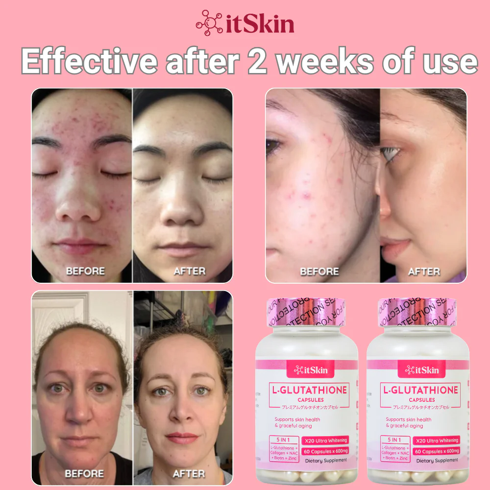 It Skin L-Glutathione It Skin L-Glutathione