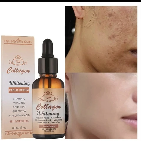 30-701-vitamin-e-c-astaxantin-hyaluronic-acid-whitening-serum-original-imagj6e8s9dshzqb 30 701 vitamin e c astaxantin hyaluronic acid whitening serum original imagj6e8s9dshzqb